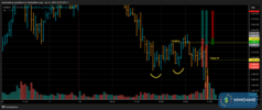 T034_XAUUSD_20250616_2BT2_BUY_CLOSE.png