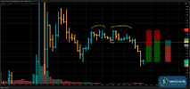 T010_EURUSD_20250717_2TT1_BUY_CLOSE.png
